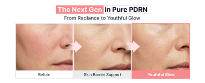 [SUNGBOON EDITOR] PDRN Pink Vitamin Glow Boosting Ampoule 35ml