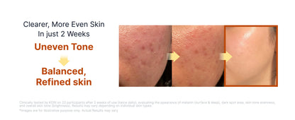 [SUNGBOON EDITOR] Kojic Acid Niacinamide Brightening Ampoule 35ml