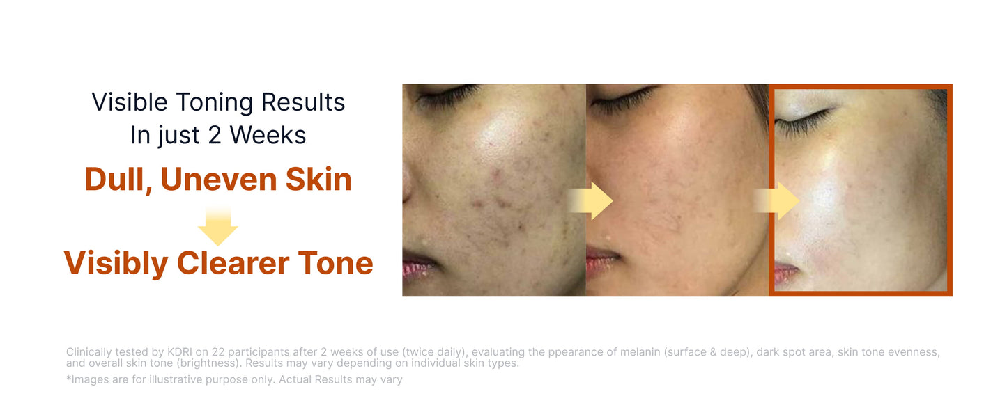 [SUNGBOON EDITOR] Kojic Acid Niacinamide Brightening Ampoule 35ml