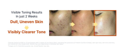 [SUNGBOON EDITOR] Kojic Acid Niacinamide Brightening Ampoule 35ml