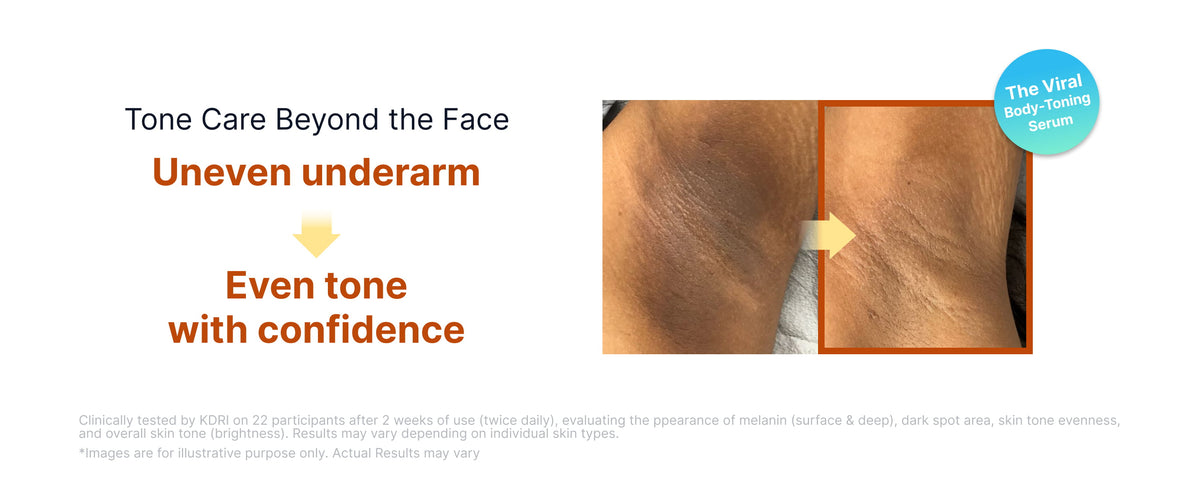 [SUNGBOON EDITOR] Kojic Acid Niacinamide Brightening Ampoule 35ml