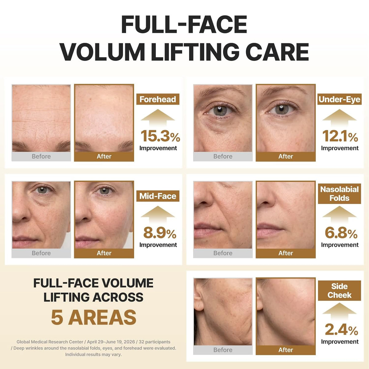 [Centellian24] Expert Madeca Cream Core Voluming Volufiline 5% 50ml