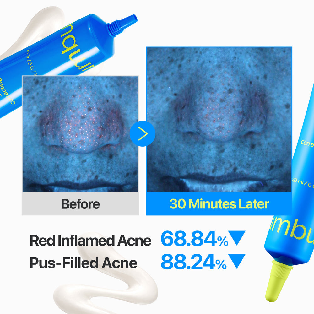[numbuzin] Zero Blemish 3X Spot Correcting Cream 20ml