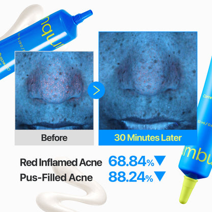 [numbuzin] Zero Blemish 3X Spot Correcting Cream 20ml