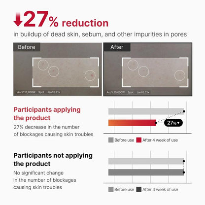 [Medicube] Red Acne Body Peeling Shot 110ml