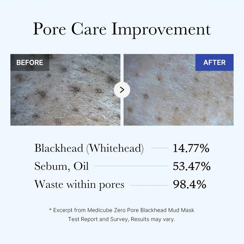[Medicube] Zero Pore Blackhead Mud Mask 100ml