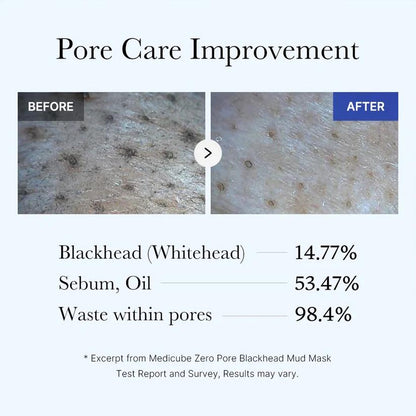 [Medicube] Zero Pore Blackhead Mud Mask 100ml